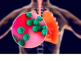 malattia di kawasaki