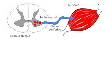 Atrofia muscolare spinale